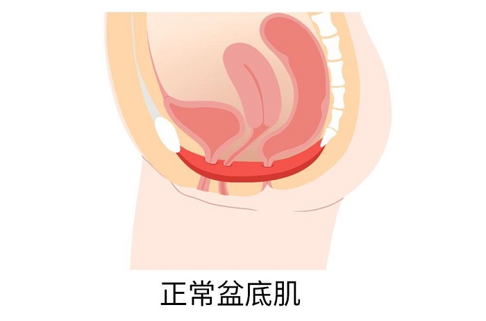 新妈妈须知：为什么要做盆底康复？盆底康复到底有多重要 - 深圳运世达心成诊所 http://www.incintaclinic.com/