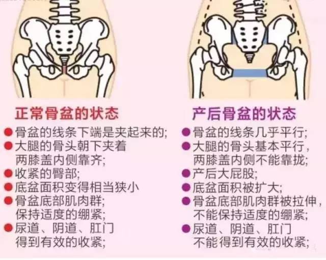 新妈妈须知：为什么要做盆底康复？盆底康复到底有多重要 - 深圳运世达心成诊所 http://www.incintaclinic.com/