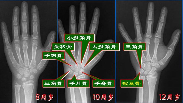 儿童身高管理|如何做好科学身高管理是每位父母的必修课！- 深圳运世达心成诊所